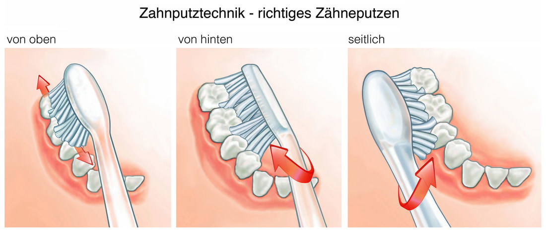 BASS-Putztechnik